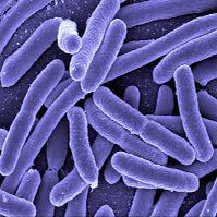 Eight Reasons Why Your UV is Not Killing Bacteria in Your Water